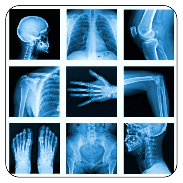 radiology review course, radiology course for nurse practitioners, radiology courses online