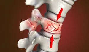 Traumatic Disorders