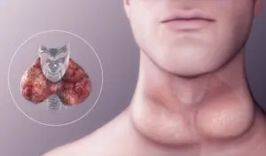 Endocrine